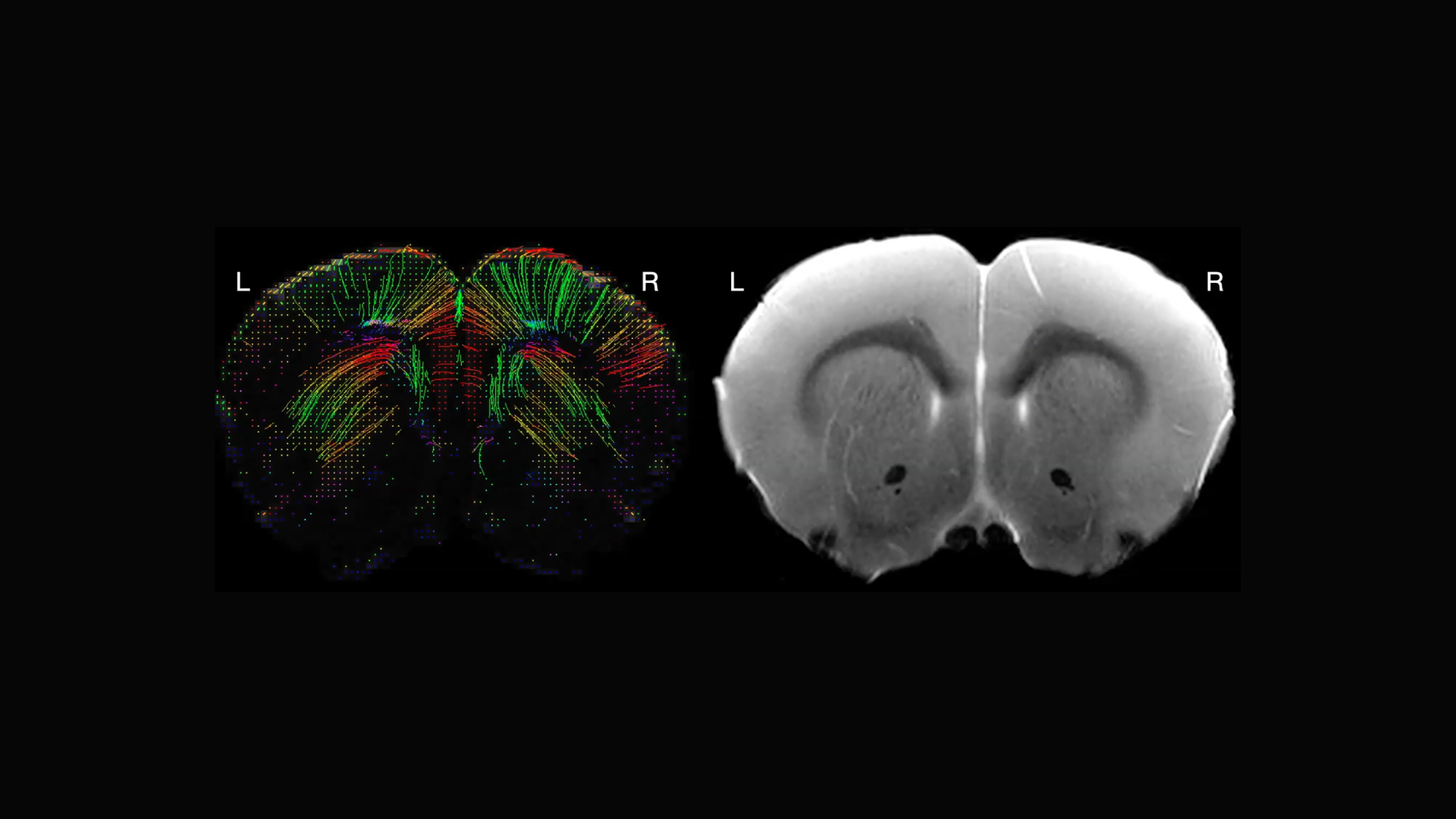 Exploring MRI's role in neuroscience research on model organisms Wu